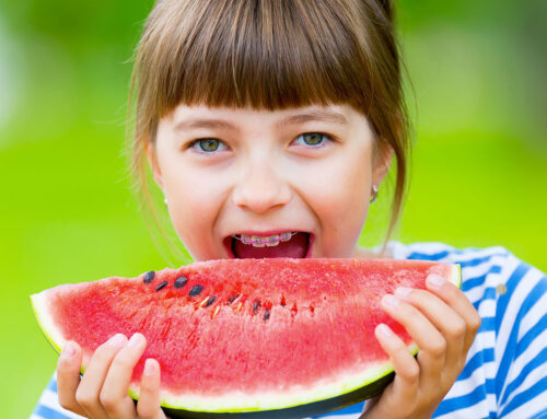 Navigating the Summer Rush: Tips for Orthodontists and Patients